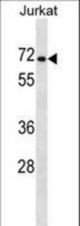 PRODH2 Antibody western blot of Jurkat cell line lysates (35 ug/lane). The PRODH2 antibody detected the PRODH2 protein (arrow).