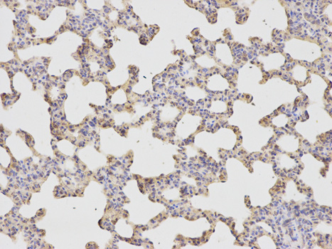 Immunohistochemistry of paraffin-embedded rat lung using HADH antibody at dilution of 1:400 (200x lens).