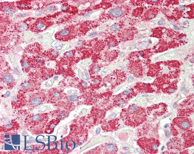 Anti-SCHAD / HADHSC antibody IHC staining of human liver. Immunohistochemistry of formalin-fixed, paraffin-embedded tissue after heat-induced antigen retrieval. Antibody LS-B11172 concentration 5 ug/ml.