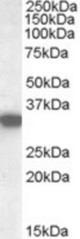 SCHAD / HADHSC Antibody (0.02 ug/ml) staining of Human Kidney lysate (35 ug protein in RIPA buffer). Primary incubation was 1 hour. Detected by chemiluminescence.
