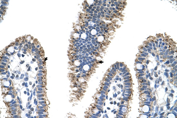 PRODH2 antibody LS-C40335 IHC of formalin-fixed, paraffin-embedded human Intestine. Positive label: Epithelial cells of intestinal villus indicated with arrows. Antibody concentration 4-8 ug/ml. Magnification 400X.
