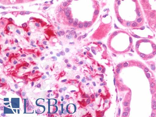Anti-SCNN1A / ENaC Apha antibody IHC staining of human kidney. Immunohistochemistry of formalin-fixed, paraffin-embedded tissue after heat-induced antigen retrieval. Antibody LS-B10784 concentration 7.5 ug/ml.