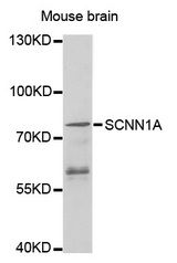 Western blot analysis of extracts of Mouse brain , using SCNN1A antibody.