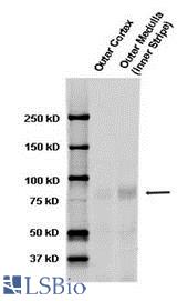Western blot analysis of ENaC-Alpha in rat kidney tissue using a 1:1000 dilution of SCNN1A / ENaC Apha antibody.