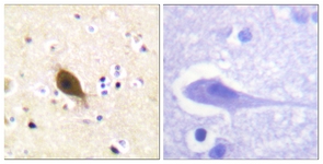 IHC of paraffin-embedded human brain tissue, using Nonvoltage-gated Sodium Channel 1 Antibody. The sample on the right was incubated with synthetic peptide.