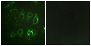 Immunofluorescence of HUVEC cells, using Nonvoltage-gated Sodium Channel 1 Antibody. The sample on the right was incubated with synthetic peptide.