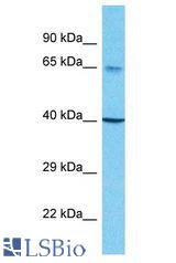 SCNN1B / ENaC Beta antibody Western Blot of 721_B. Antibody dilution: 1 ug/ml.