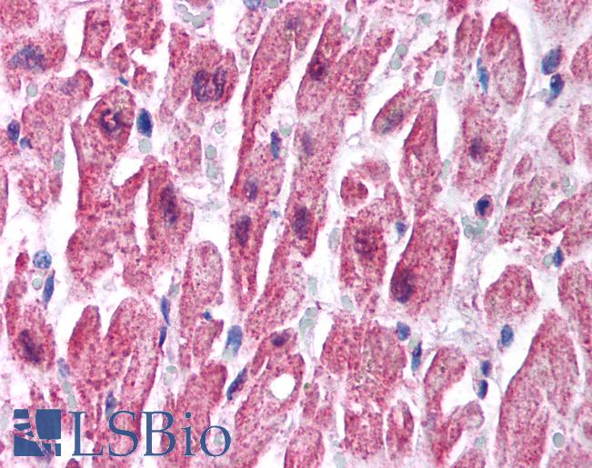 Anti-SCNN1B antibody IHC of human heart. Immunohistochemistry of formalin-fixed, paraffin-embedded tissue after heat-induced antigen retrieval. Antibody LS-B999 concentration 2.5 ug/ml.