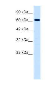 SCNN1B antibody LS-B999 Western blot of Jurkat lysate.