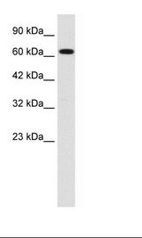 Jurkat Cell Lysate