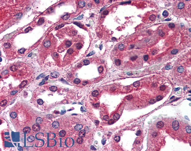 Anti-SCNN1G antibody IHC of human kidney. Immunohistochemistry of formalin-fixed, paraffin-embedded tissue after heat-induced antigen retrieval. Antibody LS-B2609 concentration 5 ug/ml.