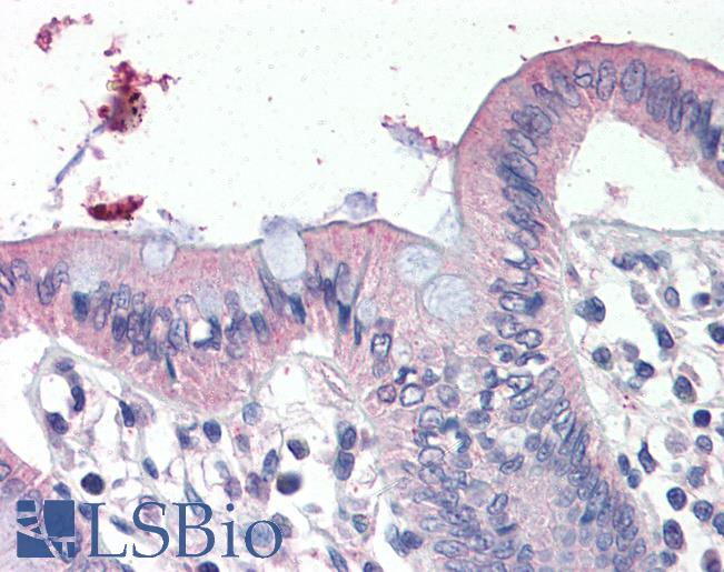 Anti-SCNN1G antibody IHC of human colon. Immunohistochemistry of formalin-fixed, paraffin-embedded tissue after heat-induced antigen retrieval. Antibody LS-B3024 concentration 4 ug/ml.