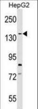SYCP1 Antibody western blot of HepG2 cell line lysates (35 ug/lane). The SYCP1 antibody detected the SYCP1 protein (arrow).
