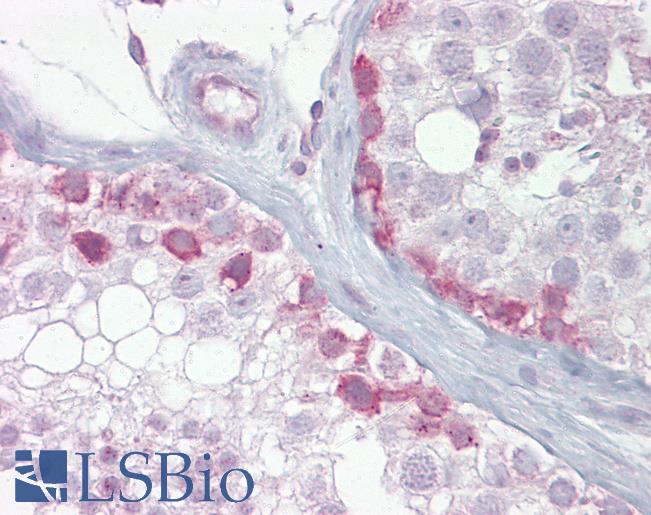 Anti-SYCP1 antibody IHC of human testis. Immunohistochemistry of formalin-fixed, paraffin-embedded tissue after heat-induced antigen retrieval. Antibody LS-B6941 concentration 5 ug/ml.