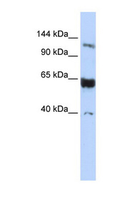SYCP1 antibody LS-B6941 Western blot of Jurkat lysate.