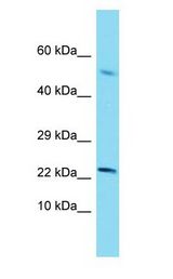 SCP2 / SCPX antibody Western Blot of Thymus Tumor. Antibody dilution: 1 ug/ml.