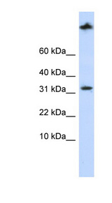 SCP2 antibody LS-C102707 Western blot of MCF7 cell lysate.
