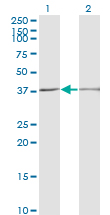 Western Blot analysis of SCP2 expression in transfected 293T cell line by SCP2 monoclonal antibody (M01), clone 2E9-1B3.Lane 1: SCP2 transfected lysate (Predicted MW: 35 KDa).Lane 2: Non-transfected lysate.