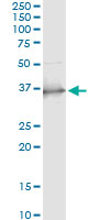Immunoprecipitation of SCP2 transfected lysate using anti-SCP2 monoclonal antibody and Protein A Magnetic Bead, and immunoblotted with SCP2 rabbit polyclonal antibody.