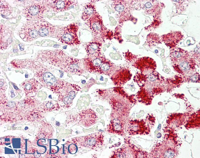 Anti-SCP2 antibody IHC of human liver. Immunohistochemistry of formalin-fixed, paraffin-embedded tissue after heat-induced antigen retrieval. Antibody LS-B7367 concentration 3.75 ug/ml.