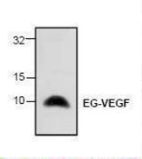 Western blot of PROK1 / EG-VEGF antibody LS-C146916.