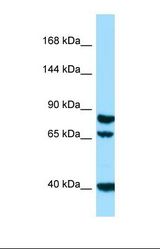 Western blot of Human HepG2. SCUBE1 antibody dilution 1.0 ug/ml.