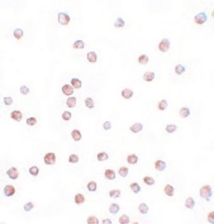 Immunocytochemistry of SCUBE1 in Daudi cells with SCUBE1 antibody at 20 ug/ml.