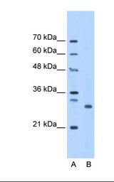 Lane A: Marker. Lane B: HepG2 cell lysate. Antibody concentration: 1.25 ug/ml. Gel concentration: 12%.