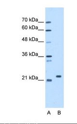 Lane A: Marker. Lane B: HepG2 cell lysate. Antibody concentration: 1.25 ug/ml. Gel concentration: 12%.