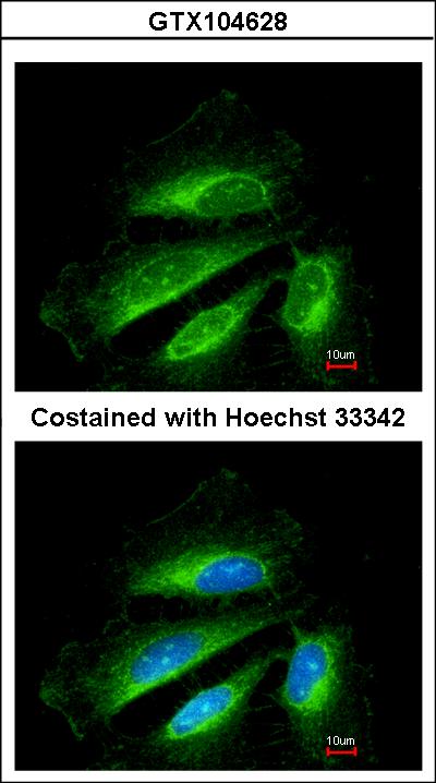Immunofluorescence of methanol-fixed HeLa using SDHB antibody at 1:200 dilution.