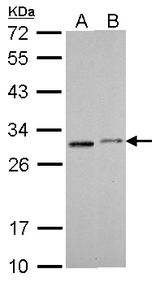 SDHB antibody [C2C3], C-term detects SDHB protein by Western blot analysis. A. 30 ug THP-1 whole cell lysate/extract. B. 30 ug NCI-H929 whole cell lysate/extract. 12 % SDS-PAGE. SDHB antibody [C2C3], C-term dilution:1:1000
