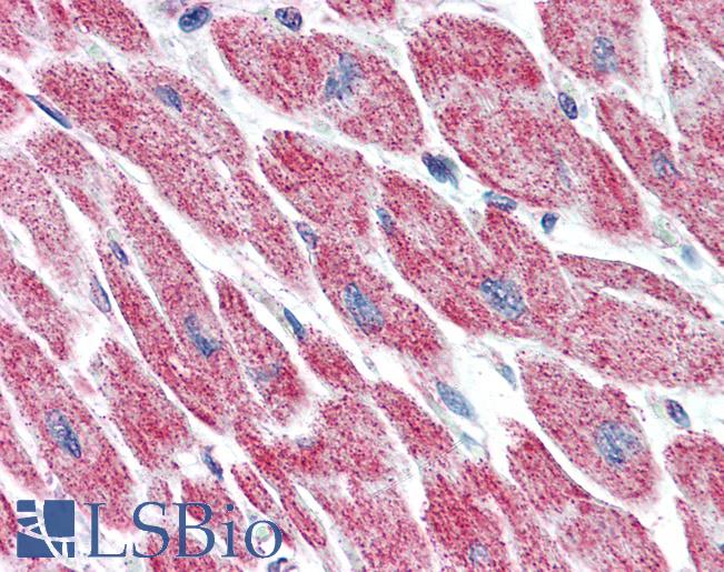 Anti-SDHB antibody IHC of human heart. Immunohistochemistry of formalin-fixed, paraffin-embedded tissue after heat-induced antigen retrieval. Antibody LS-B2872 concentration 5 ug/ml.