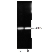 Western blot of Proteasome 19S ATPase subunit Rpt6monoclonal antibody (p45-110). Antibody dilution 1:1000 (lane a) and 1:5000 (lane b) using ECL procedure.