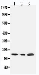 WB of SDHC antibody. All lanes: Anti-SDHC at 0.5ug/ml. Lane 1: Rat Liver Tissue Lysate at 40ug. Lane 2: HELA Tissue Lysate at 40ug. Lane 3: JURKAT Whole Cell Lysate at 40ug. Predicted bind size: 17KD. Observed bind size: 17KD.