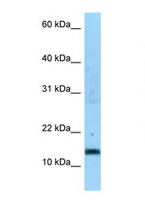 SDHC antibody LS-C146250 Western blot of 1 Cell lysate. Antibody concentration 1 ug/ml.