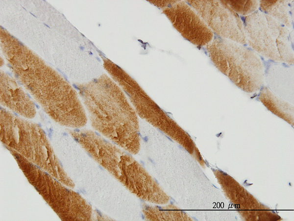 Immunoperoxidase of monoclonal antibody to SDHC on formalin-fixed paraffin-embedded human skeletal muscle (antibody concentration 3 ug/ml).