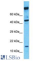 SDHC antibody Western Blot of NCI-H226. Antibody dilution: 1 ug/ml.