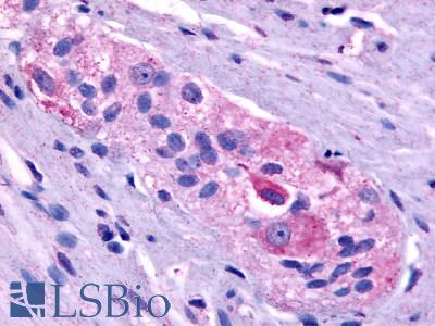 Anti-PROKR1 antibody LS-A3152 IHC of human colon. Immunohistochemistry of formalin-fixed, paraffin-embedded tissue after heat-induced antigen retrieval.