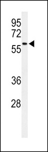 Western blot of SDR Antibody in CHO cell line lysates (35 ug/lane). SDR (arrow) was detected using the purified antibody.