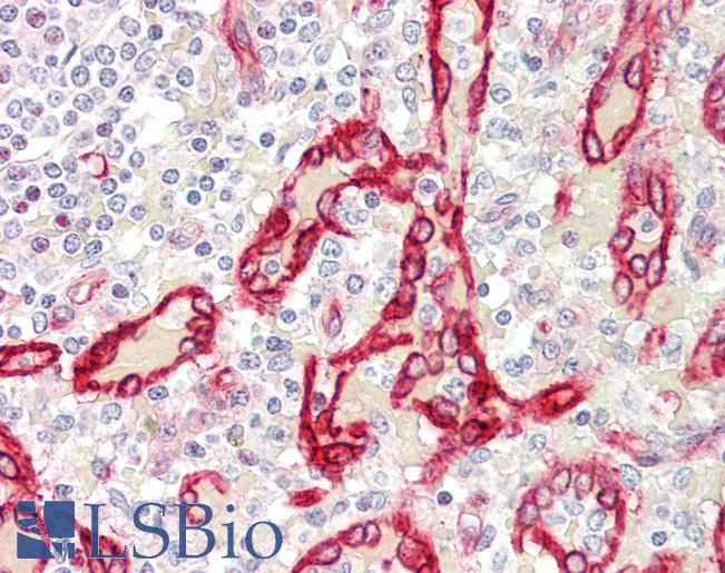 Anti-SDR / SDPR antibody IHC staining of human spleen. Immunohistochemistry of formalin-fixed, paraffin-embedded tissue after heat-induced antigen retrieval. Antibody LS-B10805 concentration 5 ug/ml.