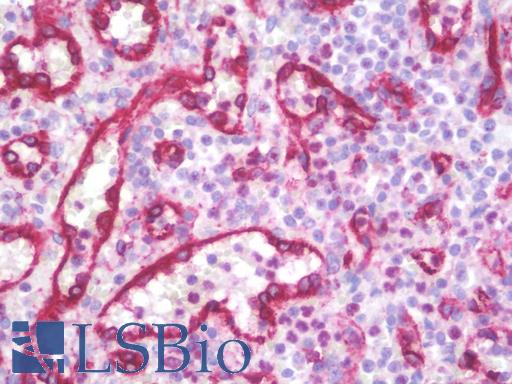 Anti-SDR / SDPR antibody IHC staining of human spleen. Immunohistochemistry of formalin-fixed, paraffin-embedded tissue after heat-induced antigen retrieval. Antibody LS-B10087 concentration 10 ug/ml.