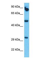 Western blot of SDR39U1 Antibody with human Thymus Tumor lysate.