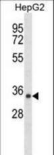 SDR39U1 Antibody western blot of HepG2 cell line lysates (35 ug/lane). The SDR39U1 antibody detected the SDR39U1 protein (arrow).