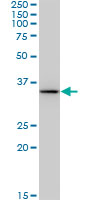 BDH1 monoclonal antibody (M03), clone 4B3. Western Blot analysis of BDH1 expression in Raw 264.7.