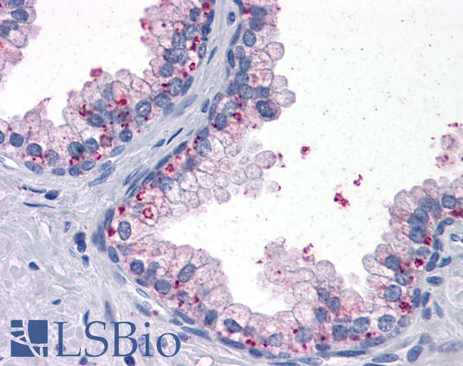 Anti-BDH1 antibody IHC of human prostate. Immunohistochemistry of formalin-fixed, paraffin-embedded tissue after heat-induced antigen retrieval. Antibody LS-B4131 dilution 1:200.