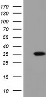 HEK293T cells were transfected with the pCMV6-ENTRY control (Left lane) or pCMV6-ENTRY SDR9C7 (Right lane) cDNA for 48 hrs and lysed. Equivalent amounts of cell lysates (5 ug per lane) were separated by SDS-PAGE and immunoblotted with anti-SDR9C7.