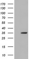 HEK293T cells were transfected with the pCMV6-ENTRY control (Left lane) or pCMV6-ENTRY SDR9C7 (Right lane) cDNA for 48 hrs and lysed. Equivalent amounts of cell lysates (5 ug per lane) were separated by SDS-PAGE and immunoblotted with anti-SDR9C7.