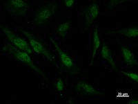 Immunostaining analysis in HeLa cells. HeLa cells were fixed with 4% paraformaldehyde and permeabilized with 0.1% Triton X-100 in PBS. The cells were immunostained with anti-PSMC5 mAb.