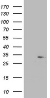 HEK293T cells were transfected with the pCMV6-ENTRY control (Left lane) or pCMV6-ENTRY SDR9C7 (Right lane) cDNA for 48 hrs and lysed. Equivalent amounts of cell lysates (5 ug per lane) were separated by SDS-PAGE and immunoblotted with anti-SDR9C7.