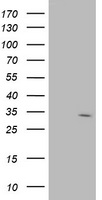 HEK293T cells were transfected with the pCMV6-ENTRY control (Left lane) or pCMV6-ENTRY SDR9C7 (Right lane) cDNA for 48 hrs and lysed. Equivalent amounts of cell lysates (5 ug per lane) were separated by SDS-PAGE and immunoblotted with anti-SDR9C7.